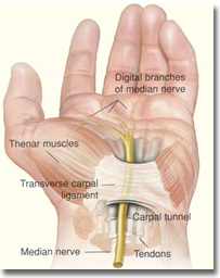 hand surgery - carpal tunnel syndrome